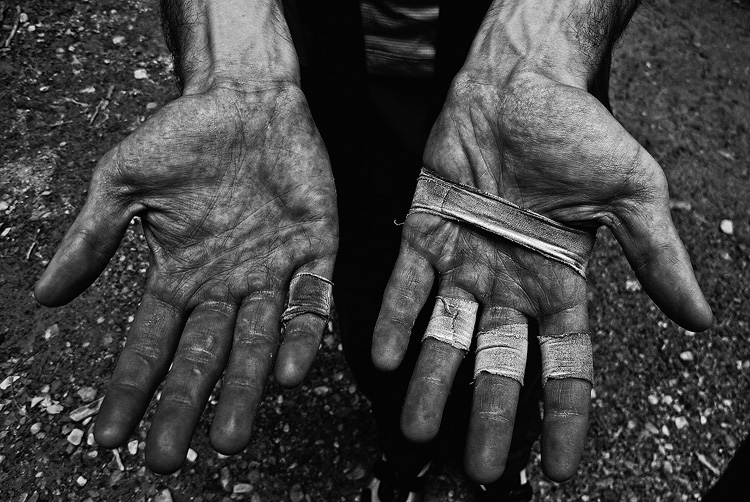 Hard on the Hands A canyoneer's beat up and dirty hands